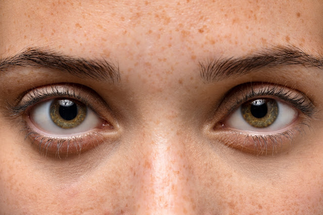 Home Remedies for Under eye Wrinkles and Dark Cricles