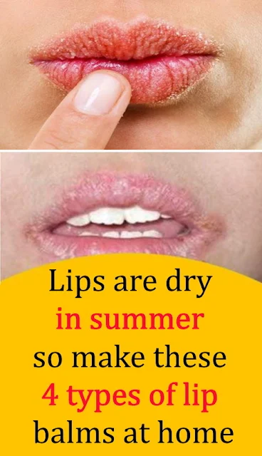 Lips Are Dry In Summer So Make These 4 Types Of Lip Balms At Home