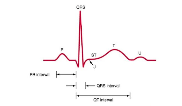Điện tâm đồ cơ bản, Học điện tâm đồ cơ bản, các sóng trên điện tâm đồ, ECG cơ bản.