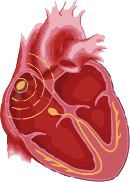 Bradycardia symptoms