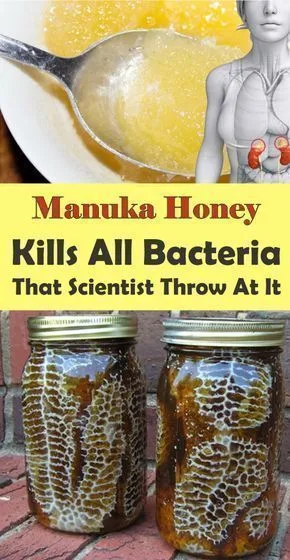 Manuka Honey Kills All Bacteria That Scientist Throw At It