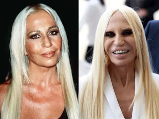 11 Celebrities Whose Plastic Surgeries Turned Out Worse Than Everyone Else