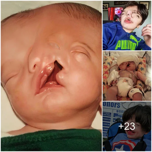 "Breaking Boundaries at 13: The Remarkable Journey of a Boy with congiined Faces Against All Odds" (Video. )