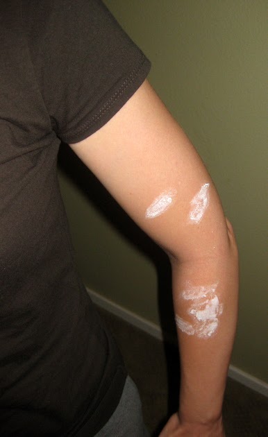 home remedy for bed bugs baking soda