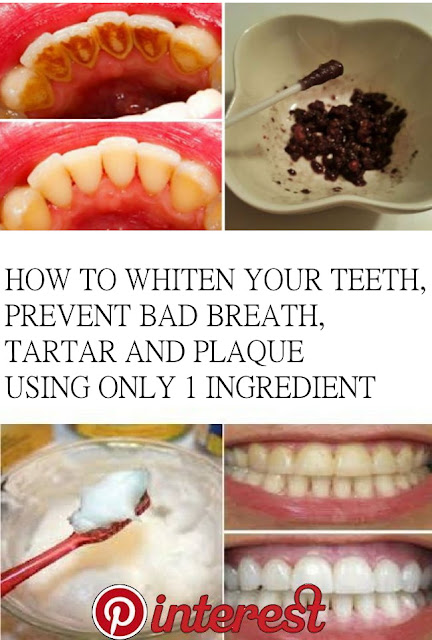 How To Whiten Your Teeth, Prevent Bad Breath, Tartar And Plaque Using Only 1 Ingredient