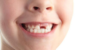  Tips Menjaga Kesehatan Gigi Anak Dunia Ibu dan Anak