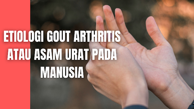 Etiologi Gout Arthritis atau Asam Urat Pada Manusia Berdasarkan penyebabnya, penyakit asam urat digolongkan menjadi 2, yaitu:  Gout primer Penyebab kebanyakan belum diketahui (idiopatik). Hal ini diduga berkaitan dengan kombinasi faktor genetik dan faktor hormonal yang menyebabkan gangguan metabolisme yang dapat mengakibatkan meningkatnya produksi asam urat.   Hiperurisemia atau berkurangnya pengeluaran asam urat dari tubuh dikatakan dapat menyebabkan terjadinya gout primer. Hiperurisemia primer adalah kelainan molekular yang masih belum jelas diketahui.   Berdasarkan data ditemukan bahwa 99% kasus adalah gout dan hiperurisemia primer. Gout arthritis primer yang merupakan akibat dari hiperurisemia primer, terdiri dari hiperurisemia karena penurunan ekskresi (80-90%) dan karena produksi yang berlebih (10-20%).    Gout Sekunder Gout sekunder dibagi menjadi beberapa kelompok yaitu kelainan yang menyebabkan peningkatan biosintesis de novo, kelainan yang menyebabkan peningkatan degradasi ATP atau pemecahan asam nukleat dan kelainan yang menyebabkan sekresi menurun.   Hiperurisemia sekunder karena peningkatan biosintesis de novo terdiri dari kelainan karena kekurangan menyeluruh enzim HPRT pada syndome Lesh-Nyhan, kekurangan enzim glukosa-6 phosphate pada glycogen storage disease dan kelainan karena kekurangan enzim fructose-1 phosphate aldolase melalui glikolisis anaerob.   Hiperurisemia sekunder karena produksi berlebih dapat disebabkan karena keadaan yang menyebabkan peningkatan pemecahan ATP atau pemecahan asam nukleat dari dari intisel.   Peningkatan pemecahan ATP akan membentuk AMP dan berlanjut membentuk IMP atau purine nucleotide dalam metabolisme purin, sedangkan hiperurisemia akibat penurunan ekskresi dikelompokkan dalam beberapa kelompok yaitu karena penurunan masa ginjal, penurunan filtrasi glomerulus, penurunan fractional uric acid clearence dan pemakaian obat-obatan.    Nah itu dia bahasan dari etiologi gout arthritis atau asam urat pada manusia, melalui bahasan di atas bisa diketahui mengenai etiologi gout arthritis atau asam urat pada manusia. Mungkin hanya itu yang bisa disampaikan di dalam artikel ini, mohon maaf bila terjadi kesalahan di dalam penulisan, dan terimakasih telah membaca artikel ini."God Bless and Protect Us"