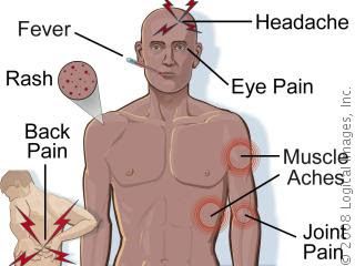 Nursing Interventions for Dengue Fever Nursing Diagnosis Hyperthermia