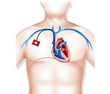 alimentation et cancer poumon oncologie journal