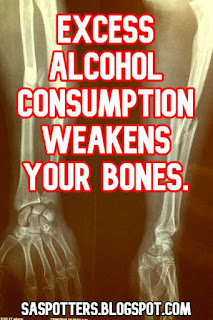 Excess alcohol consumption weakens your bones.