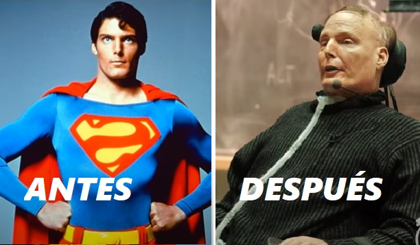 SUPERMAN ACTOR AHORA NO PUEDE CAMINAR