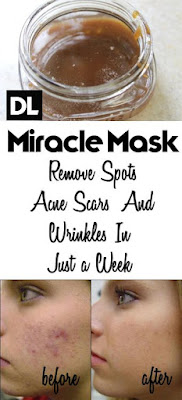 Homemade Face Mask to Get Rid of Spots, Acne Scars, and Wrinkles
