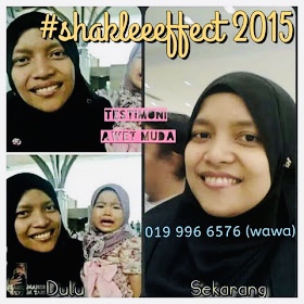 Set cantik shaklee, Set Cantik Bajet Shaklee, Set Cantik Premium Shaklee Harga set cantik shaklee Keistimewaan set cantik shaklee Cara makan set cantik shaklee ESP SHAKLEE, testimoni set cantik shaklee bebas jerawat, bebas parut, testimoni set cantik shaklee, testimoni set cantik premium  shaklee, testimoni set cantik shaklee - resv dan vivix, testimoni resv shaklee, testimoni vivix shaklee, testimoni resv shaklee untuk cantik, testimoni vivix shaklee untuk kulit cantik, testimoni set cantik shaklee,set cantik bajet shaklee  testimoni set cantik shaklee  set cantik shaklee new packaging  harga set cantik shaklee  set kulit cantik shaklee bajet  youth shaklee  set kurus shaklee  cara makan set kecantikan shaklee