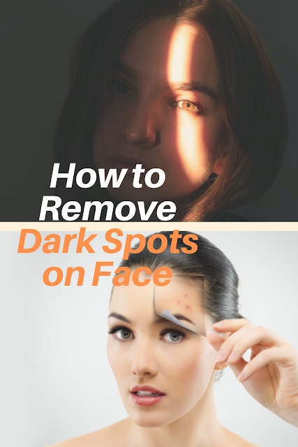 How to Remove Dark Spots on Face