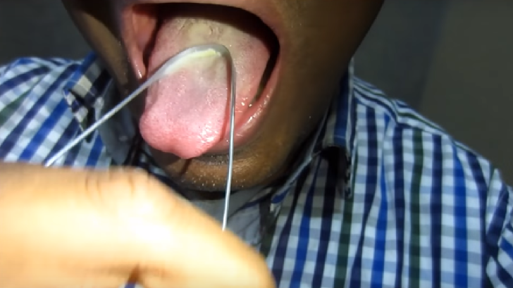 Tongue scraping