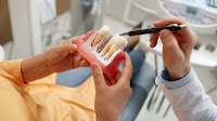 Menemukan Solusi Terbaik untuk Kesehatan Gigi Anda dengan Implan Gigi di Arirang Dental Clinic