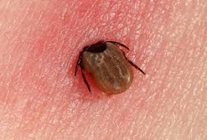 Tick attached to human skin