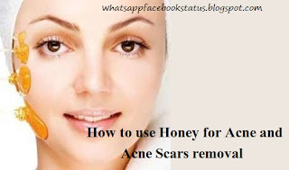 Image result for How to use Honey For Acne ?