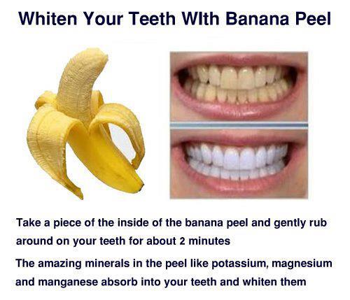 The Best Natural Teeth Whitening Technique That Can Transform Your 