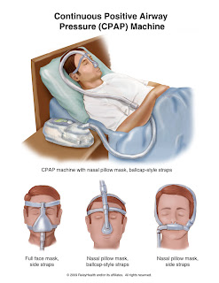 CPAP Machine Reviews