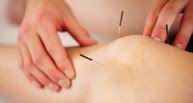 acupuncture-program