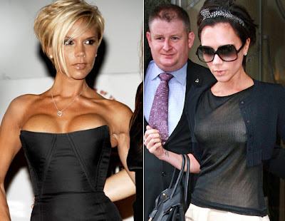 OFF HER CHEST: Victoria Beckham has confirmed she had her DD breast implants