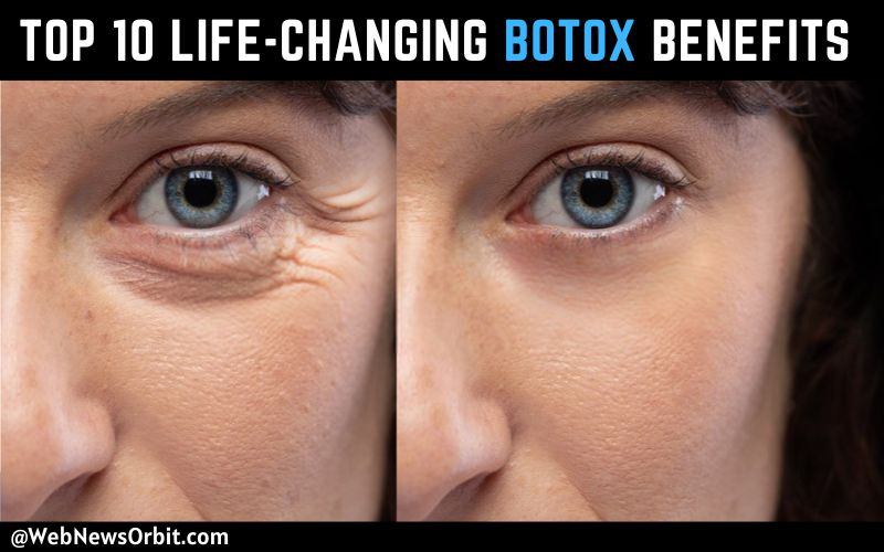 Top 10 Life-Changing Botox Benefits You Cant Ignore 1 - WebNewsOrbit.com