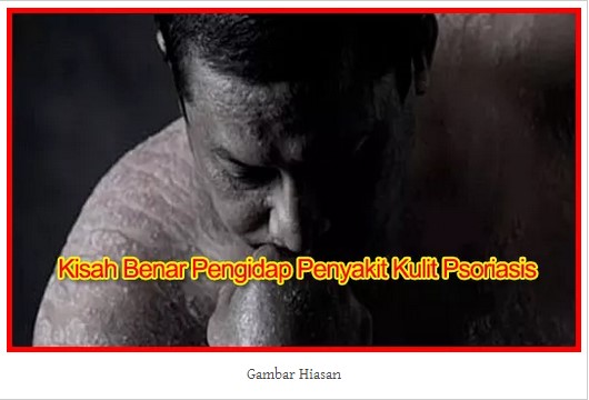 Penawar Utama Penyakit Psoriasis & Semua Jenis Penyakit 