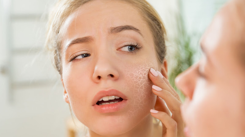 ¿Cómo cuidar la piel seca?