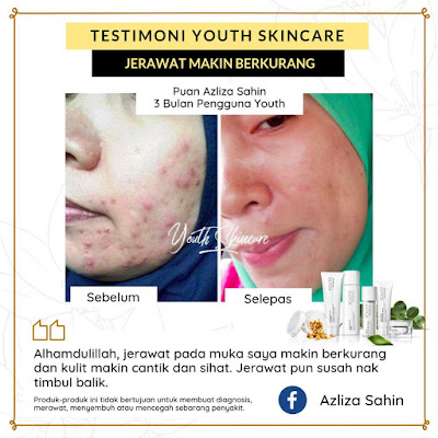 Testimoni Youth Skincare Untuk Jerawat