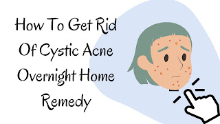 How To Get Rid Of Cystic Acne Overnight Home Remedy