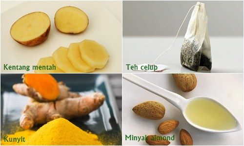 4 Bahan Alami Untuk Mengatasi Kantung Mata