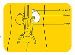 best treatment for renal cell carcinoma