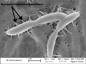 Acetobacter xylinum