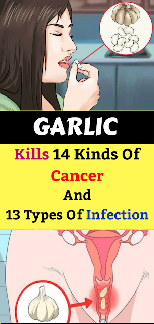 Garlic Kills 14 Kinds Of Cancer And 13 Types Of Infection. Why Don’t Doctors Prescribe It?