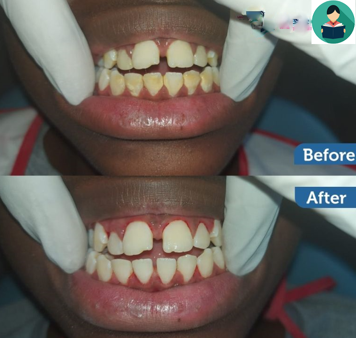 10 Best Teeth Whitening Clinics in Nairobi