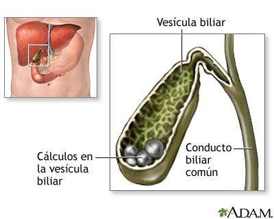 ubicación anatómica de la vésicula biliar y cálculos alojados en ella