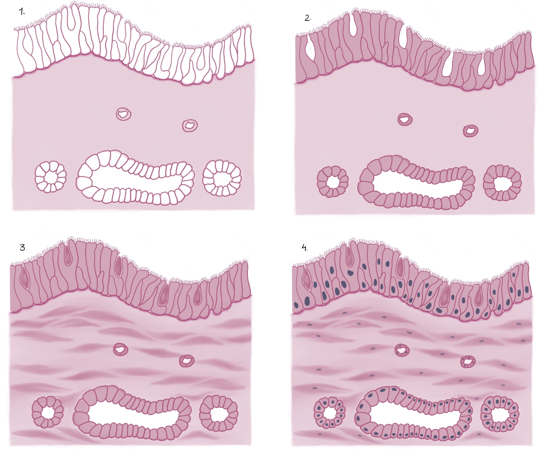 Steps for drawing Pseudo-stratified columnar epithelium