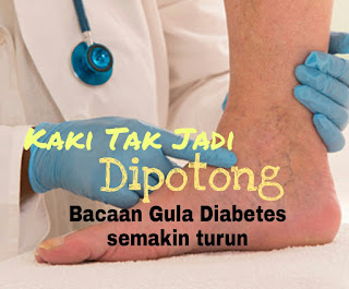 kaki tak jadi dipotong