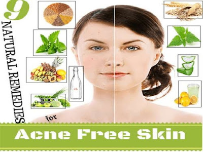 All Natural Acne Treatments   
