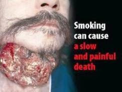 The Health Effect Of Smoking
