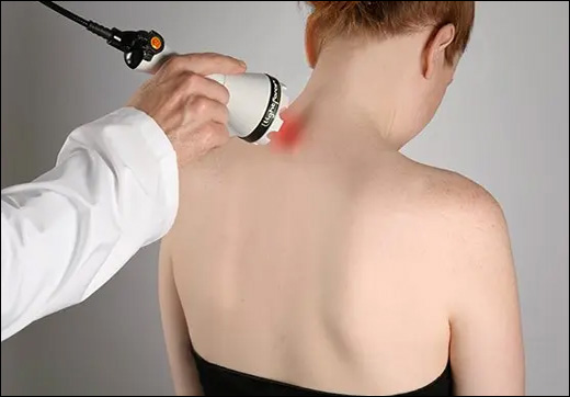 Low-Level Laser Therapy, Effects Of Low-Level Laser Therapy, Low-Level Laser Therapy In Ayurveda, Red Light Therapy, Benefits Of Red Light Therapy, Herbal Remedies, Ayurvedic Treatment, Herbal Products