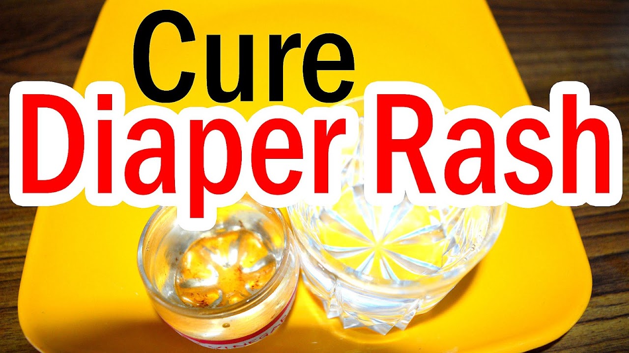 Diaper Rash Treatment Home Remedies