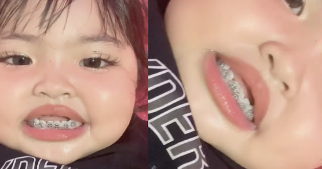 “Itukan Gigi Susu..“ – Tular Video Bayi Dipakaikan ‘Braces’, Netizen Kecam Ibu Bapa Buat Demi ‘Content’