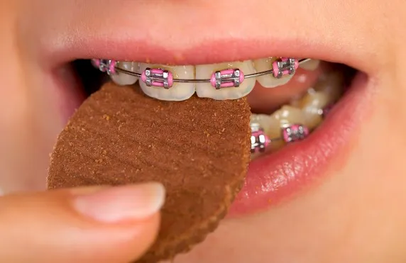 Can You Eat Brownies With Braces?