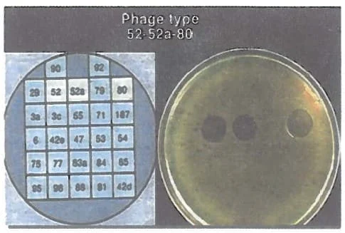 Phage typing