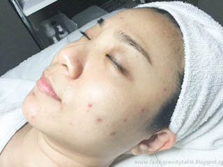 Review of Caring Skin facial Singapore