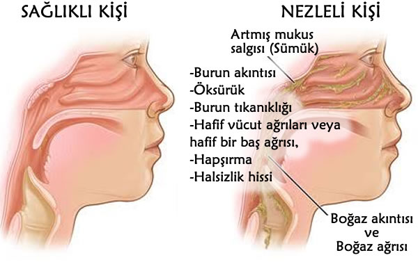 soğuk algınlığının bitkisel tedavisi