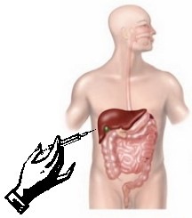 lver_biopsy01