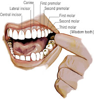 Teeth Disorder